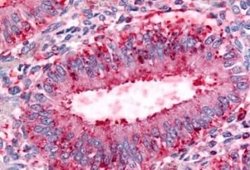 DPP8 Antibody, Novus Biologicals 50 &mu;g; Unconjugated:Antibodies, Polyclonal